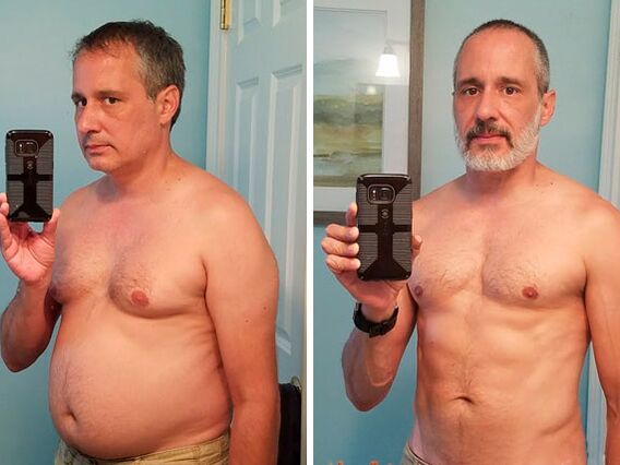 Antes e despois do tratamento con pingas de valor ZXCVBNMQ